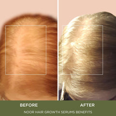 NOOR HAIR Wonder Growth Spray: gouttes sur cheveux pour un soin ciblé après lavage.