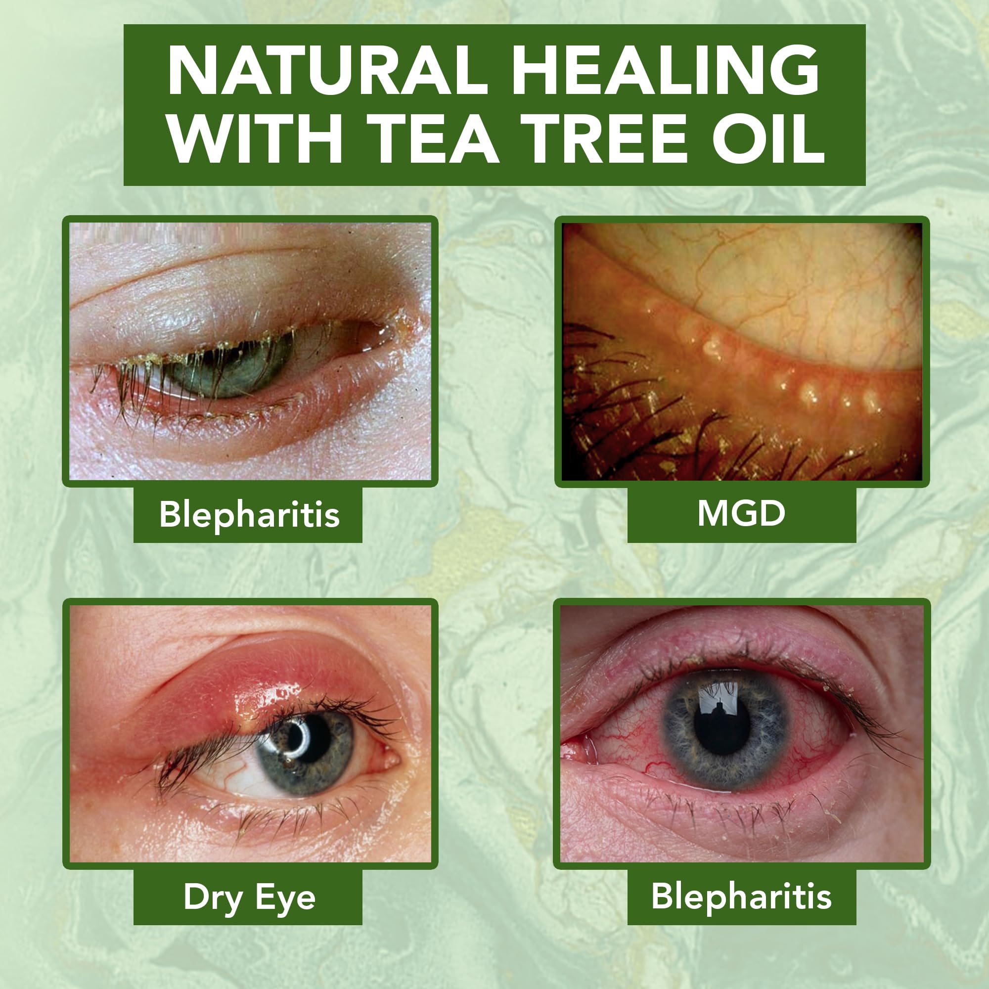 NOVEHA Tea Tree con B5 y E: ingredientes para soporte de elasticidad.