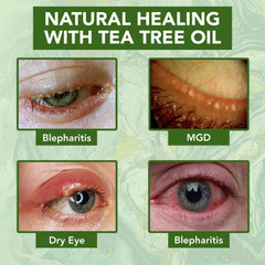 NOVEHA Tea Tree con B5 y E: ingredientes para soporte de elasticidad.