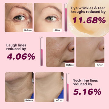 Nuckhuce Calcium Multi Balm Stick para cuello: cuidado específico.