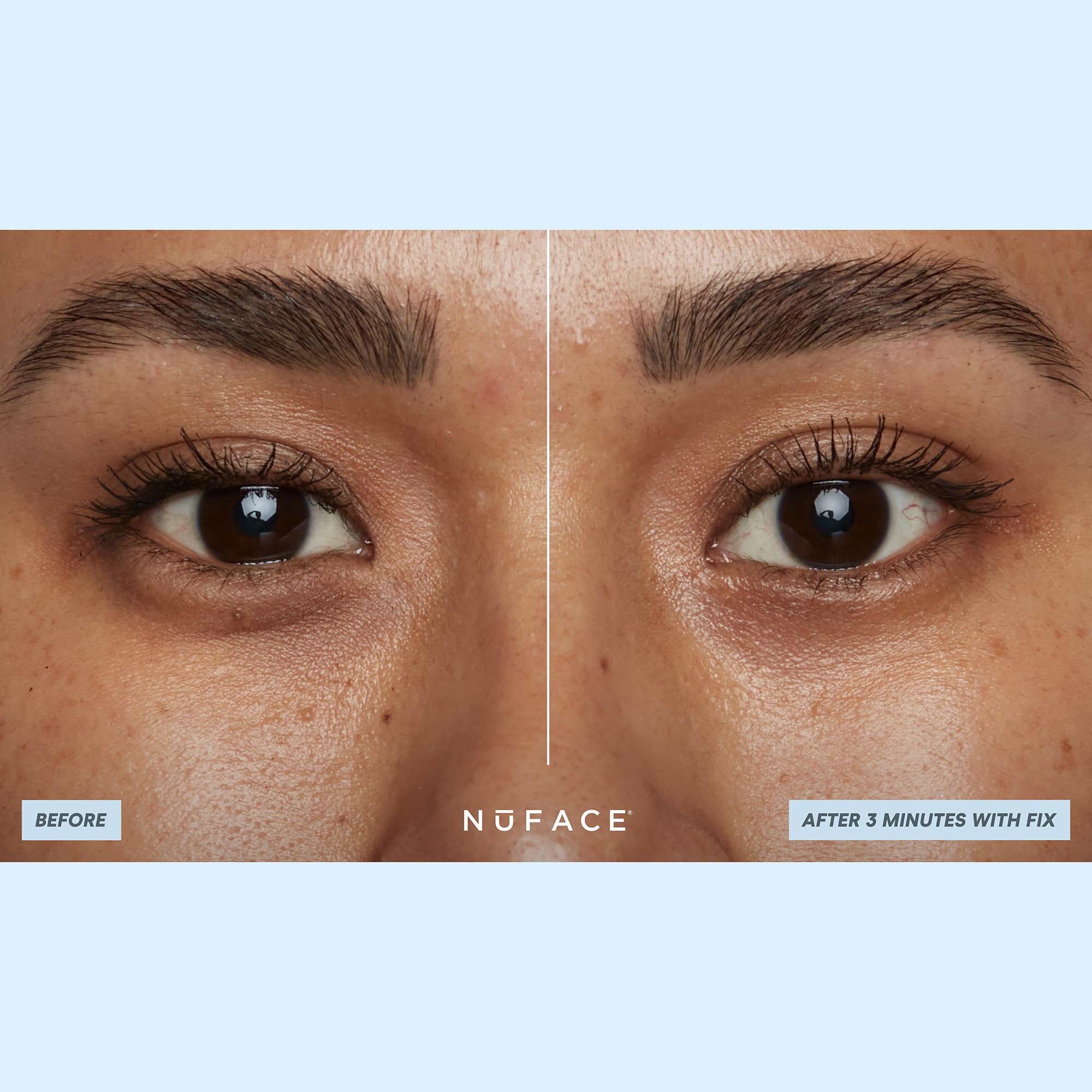 NuFACE IonPlex Hydra-Gel con magnesio y arginina, ayuda a suavizar líneas alrededor de ojos.