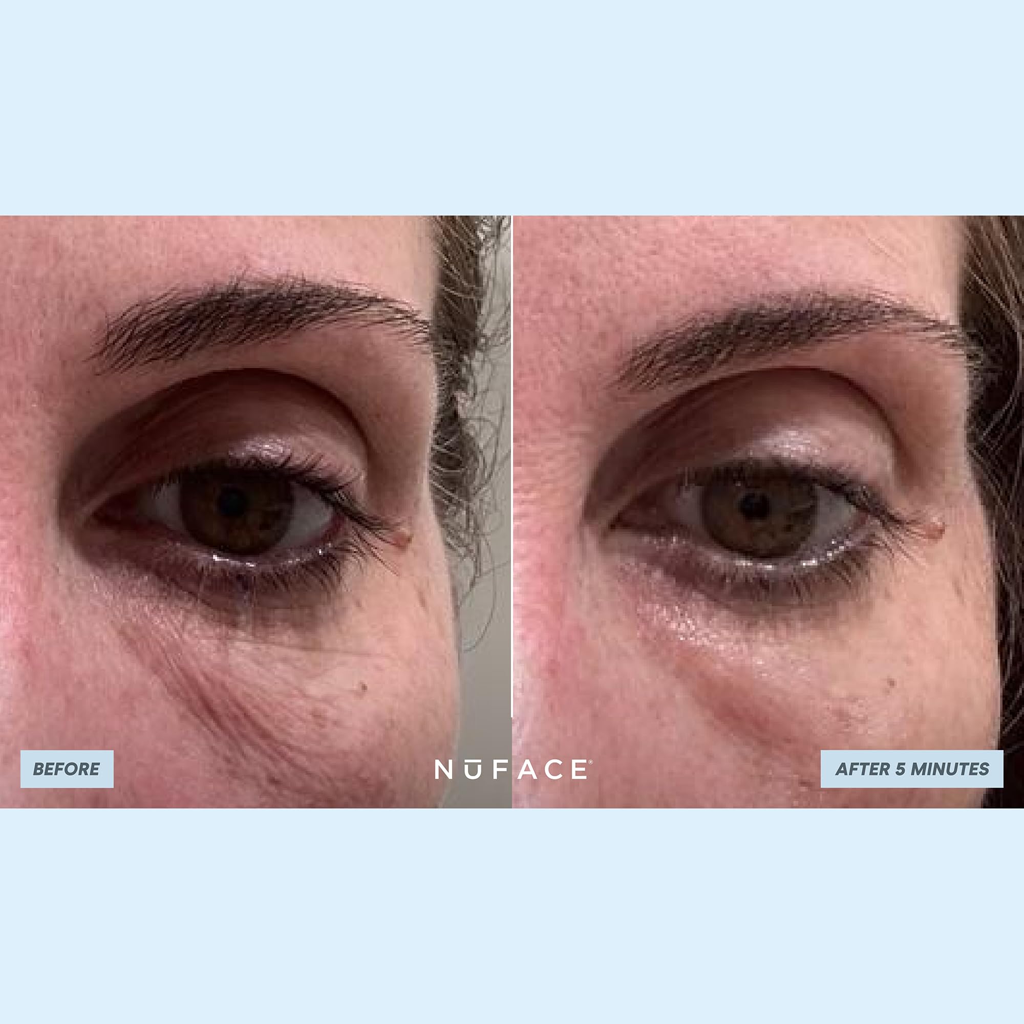 NuFACE IonPlex Hydra-Gel, opción vegana y biodegradable para cuidado ocular.