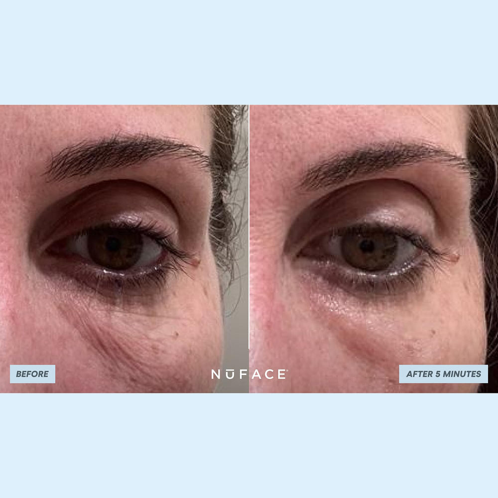 NuFACE IonPlex Hydra-Gel, opción vegana y biodegradable para cuidado ocular.