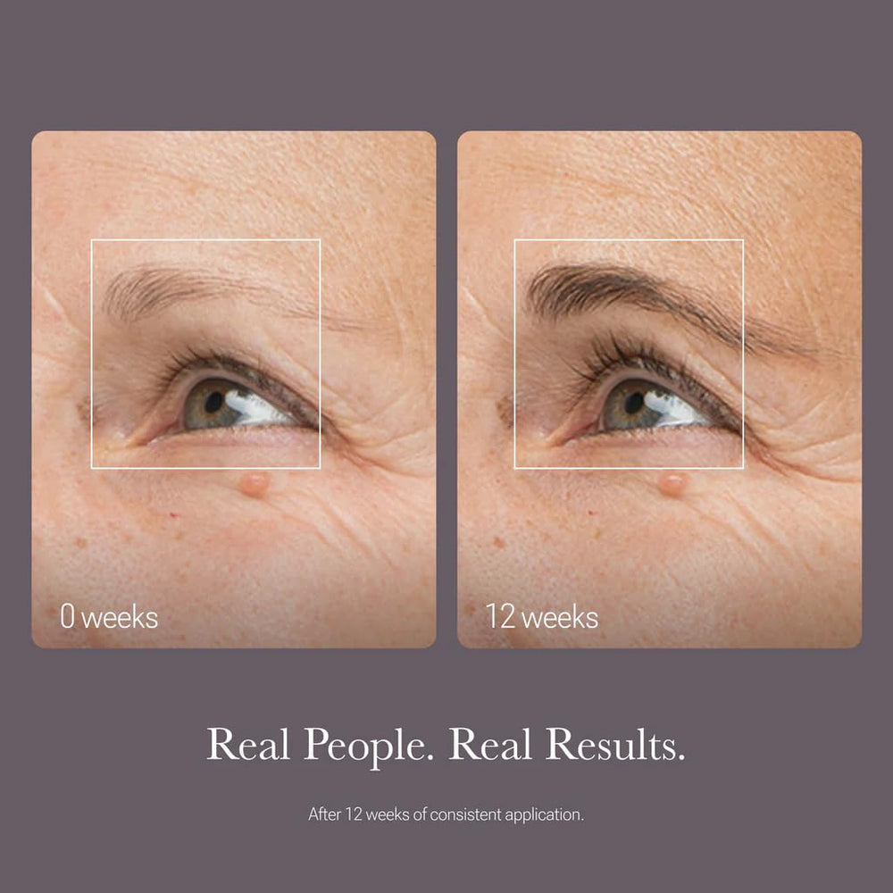 NULASTIN suero para cejas, densidad visual mejorada según evaluaciones.