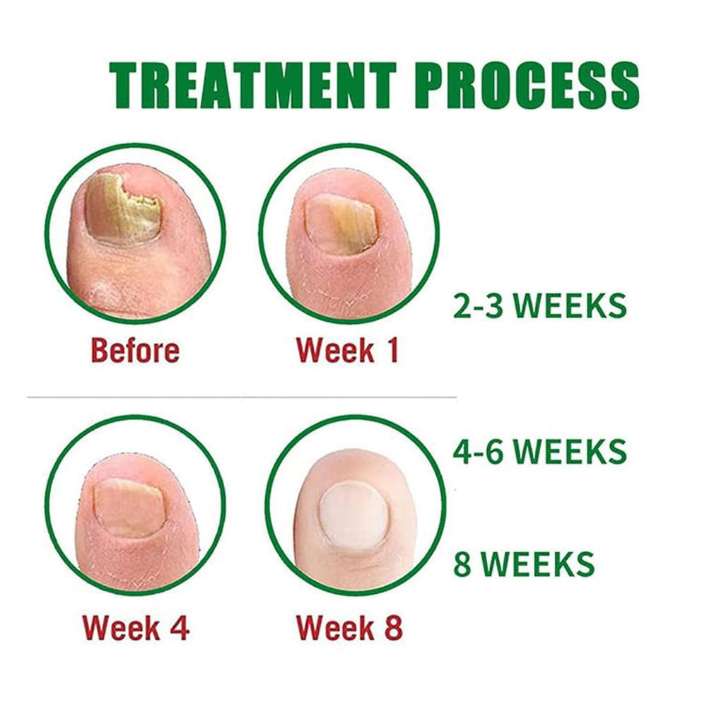 Nutraboost Nail Aceite Oliva, formula nutritiva para uñas y piel de los pies