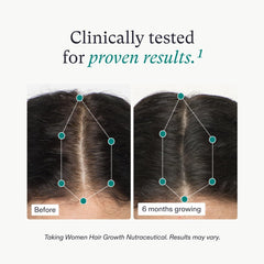 Nutrafol cápsulas diarias: dosis simples para rutina de cabello.