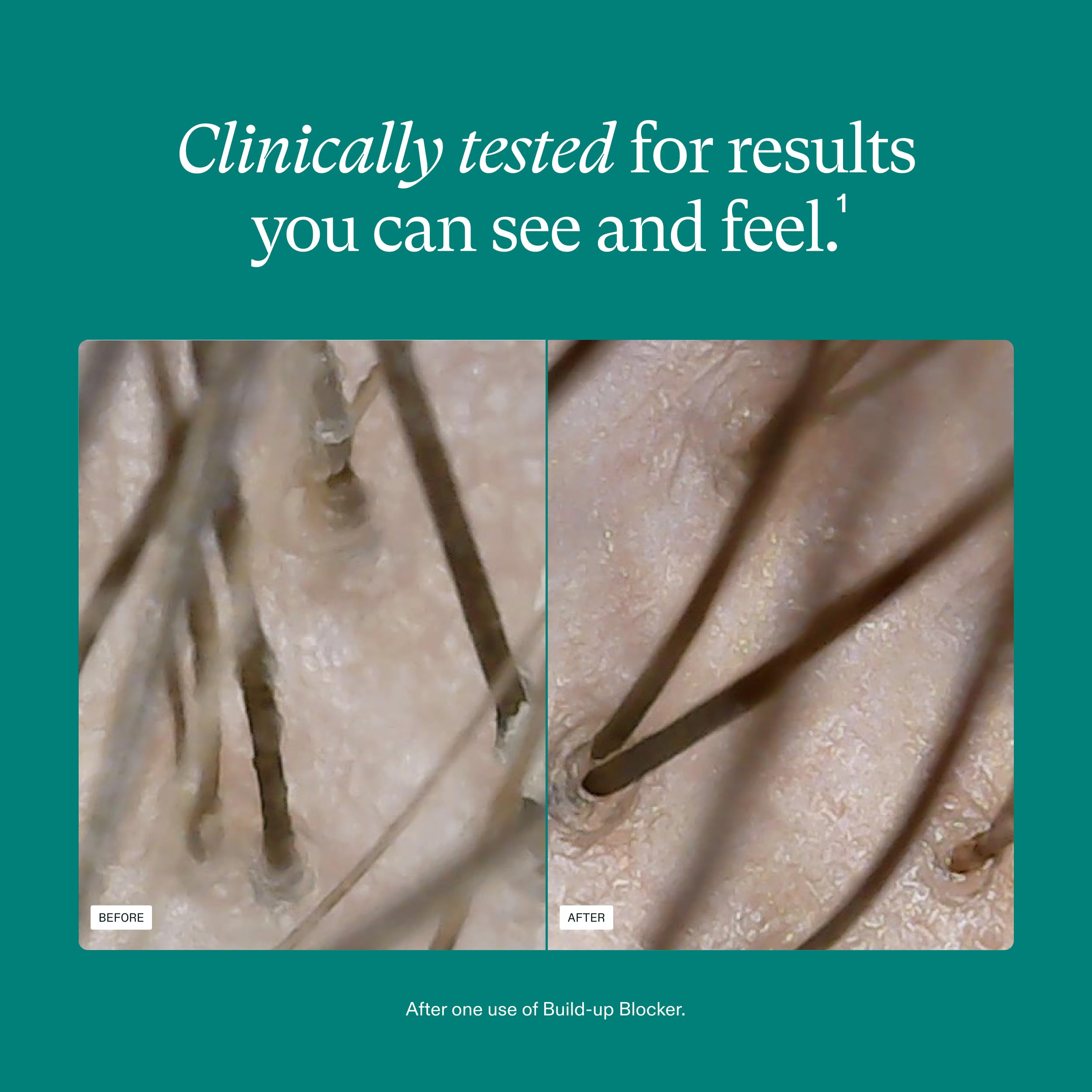 Composición con impurezas extraídas por exfoliación para cuero cabelludo limpio