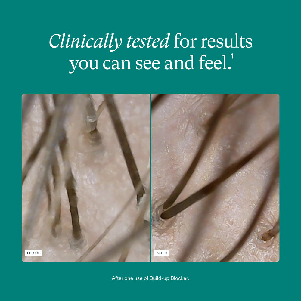 Composición con impurezas extraídas por exfoliación para cuero cabelludo limpio