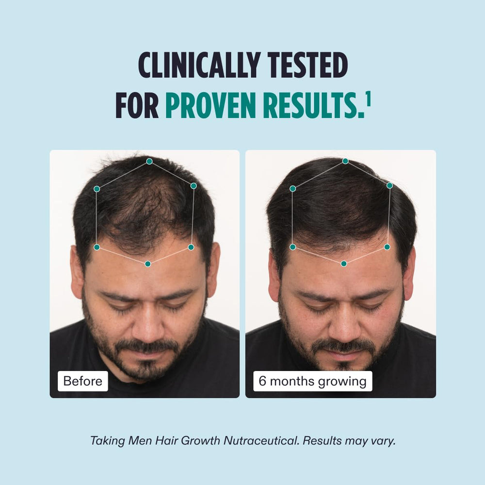 Dúo de acción para fortalecer el cabello desde la raíz.