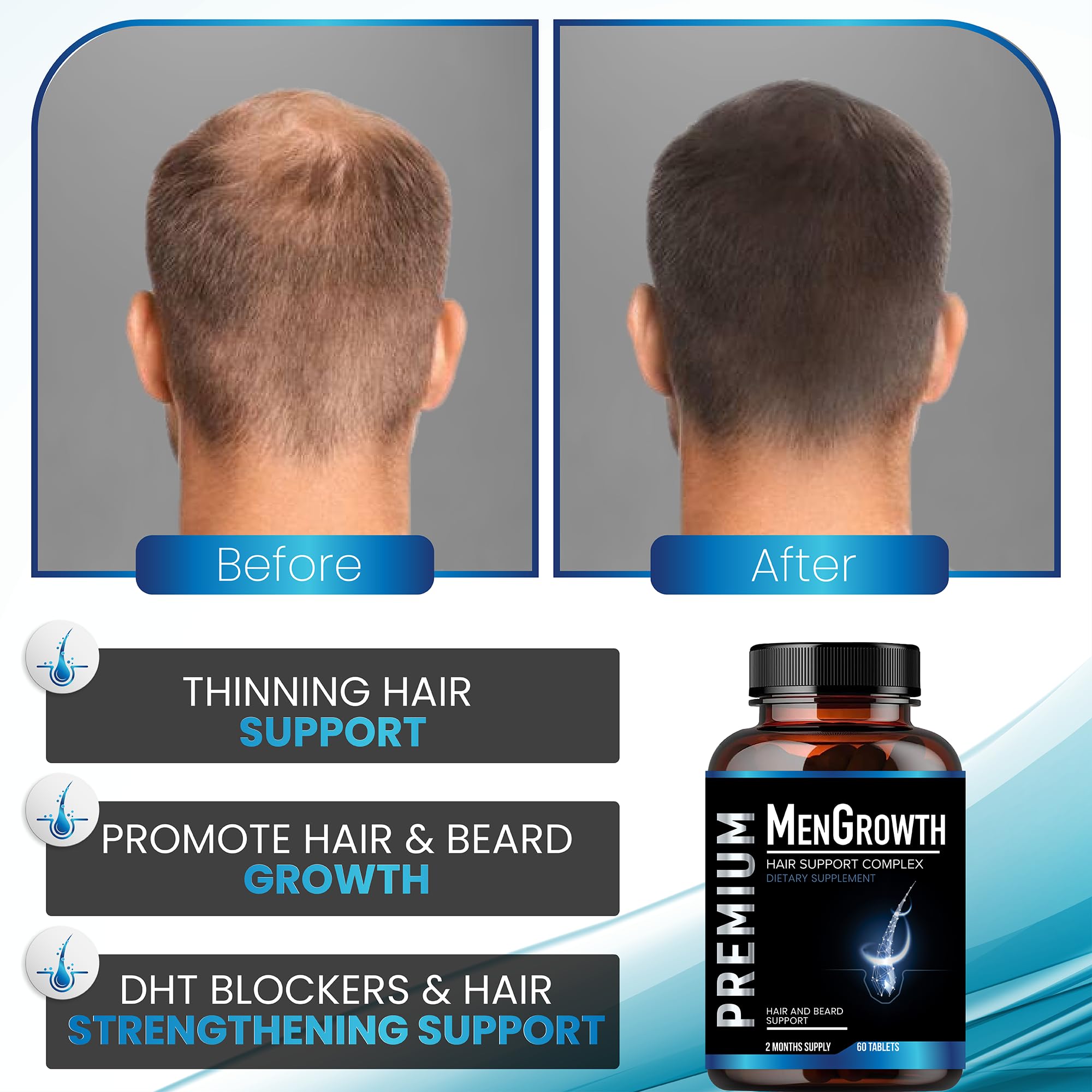 NutraPro MenGrowth: vitaminas que fomentan la regeneración capilar en hombres.