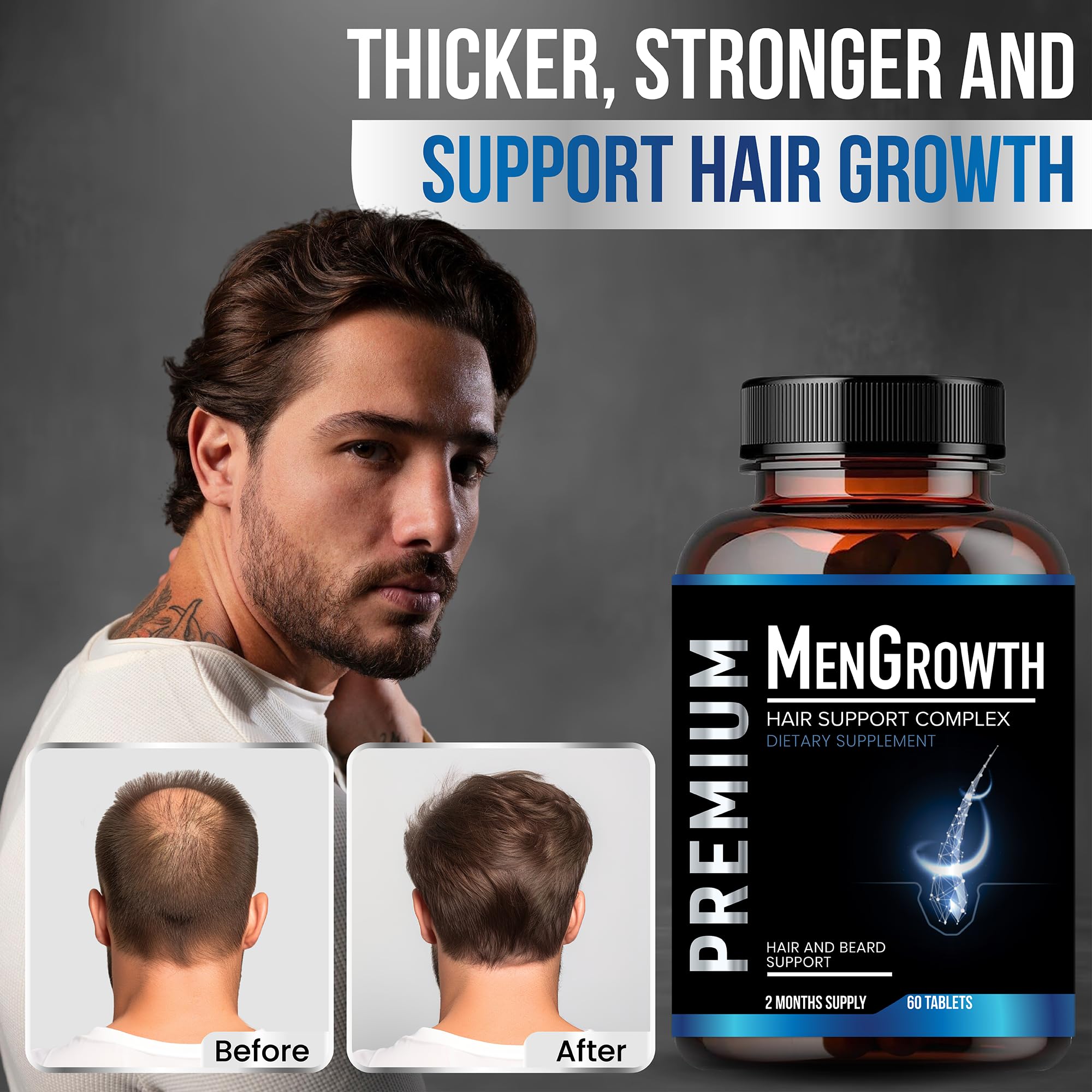 NutraPro MenGrowth: vitaminas para el cabello de hombres fortalecen desde dentro.