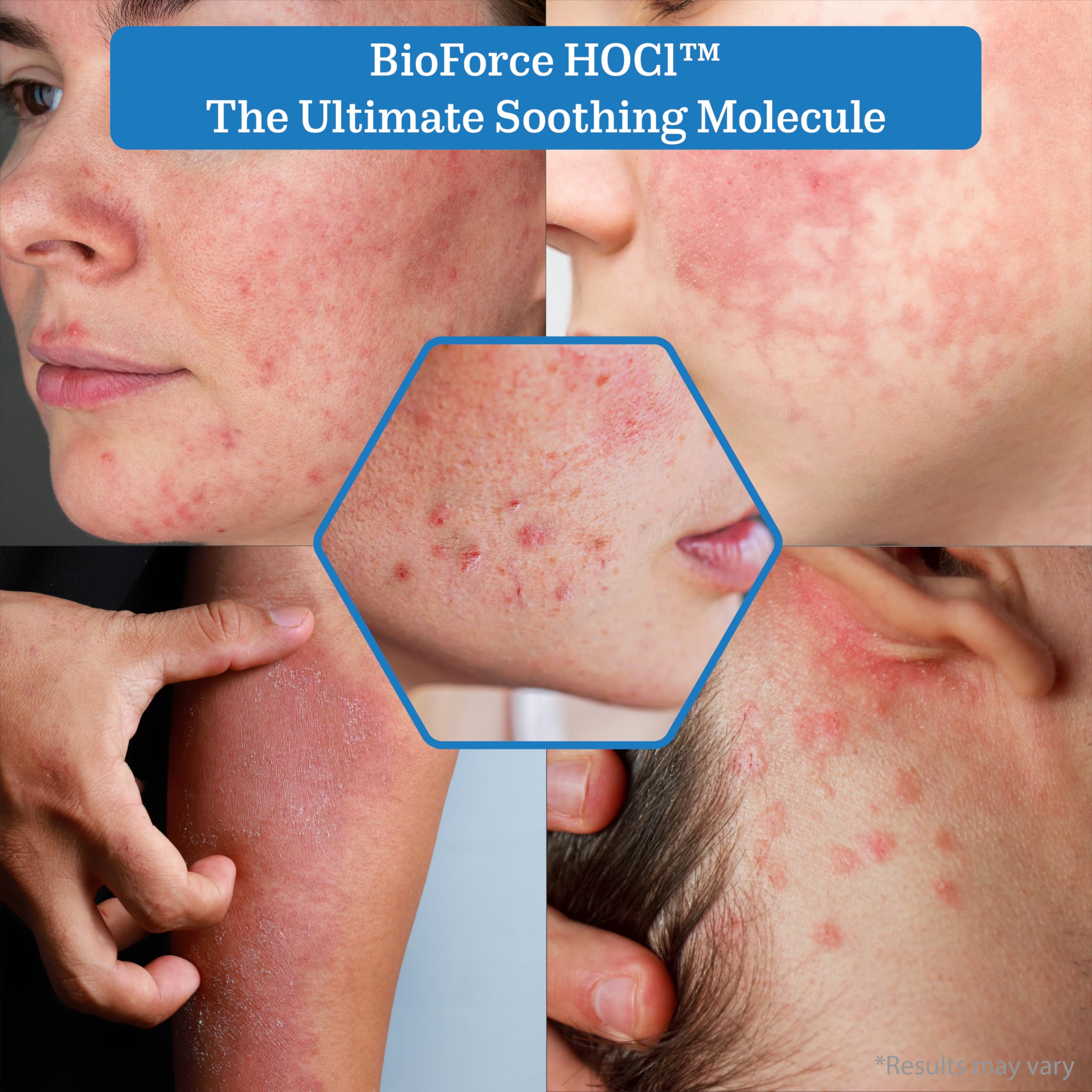 NuVue BioForce HOCl spray para espalda, cobertura rápida y ligera.