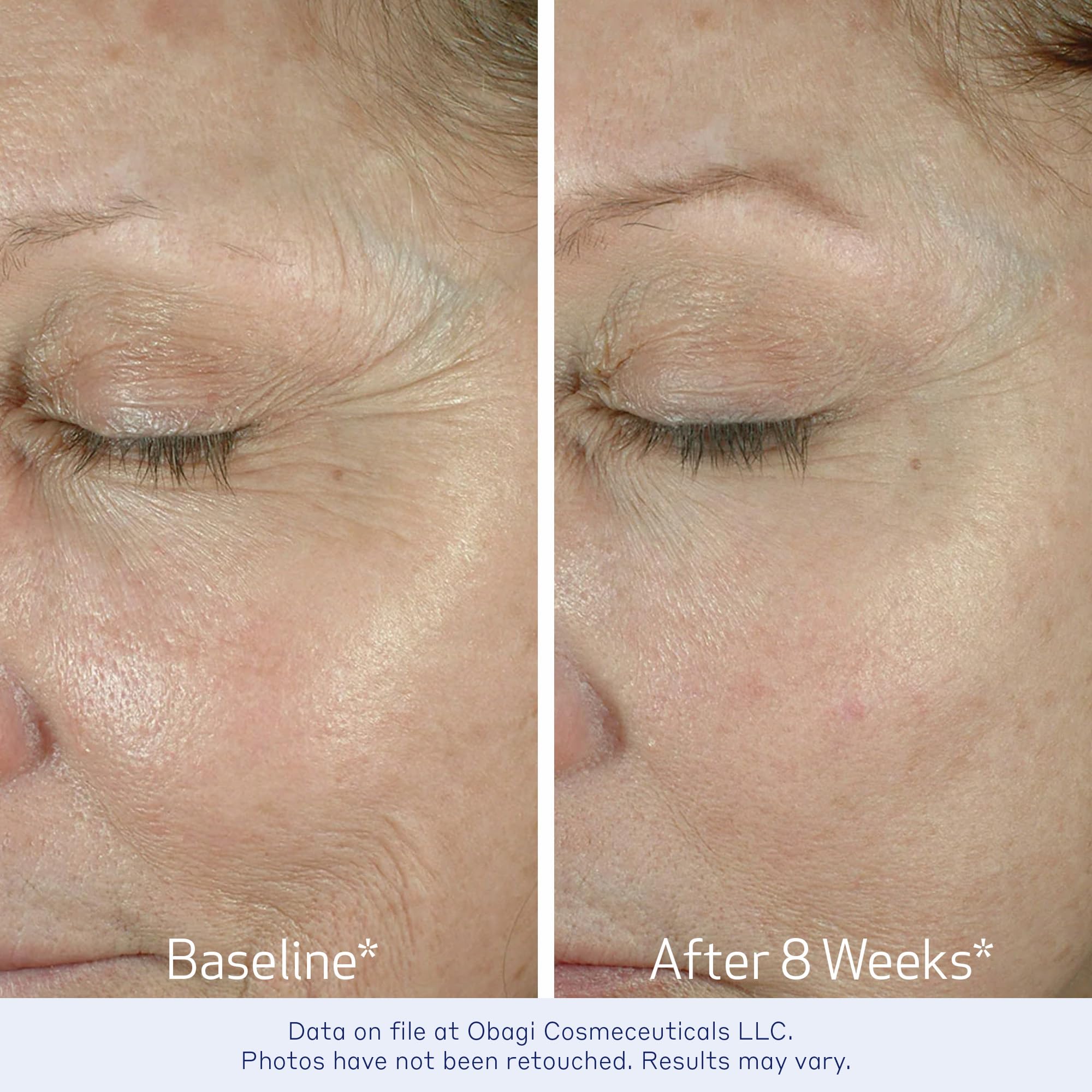 Complejo bi-mineral de Obagi ELASTIderm para mayor firmeza.