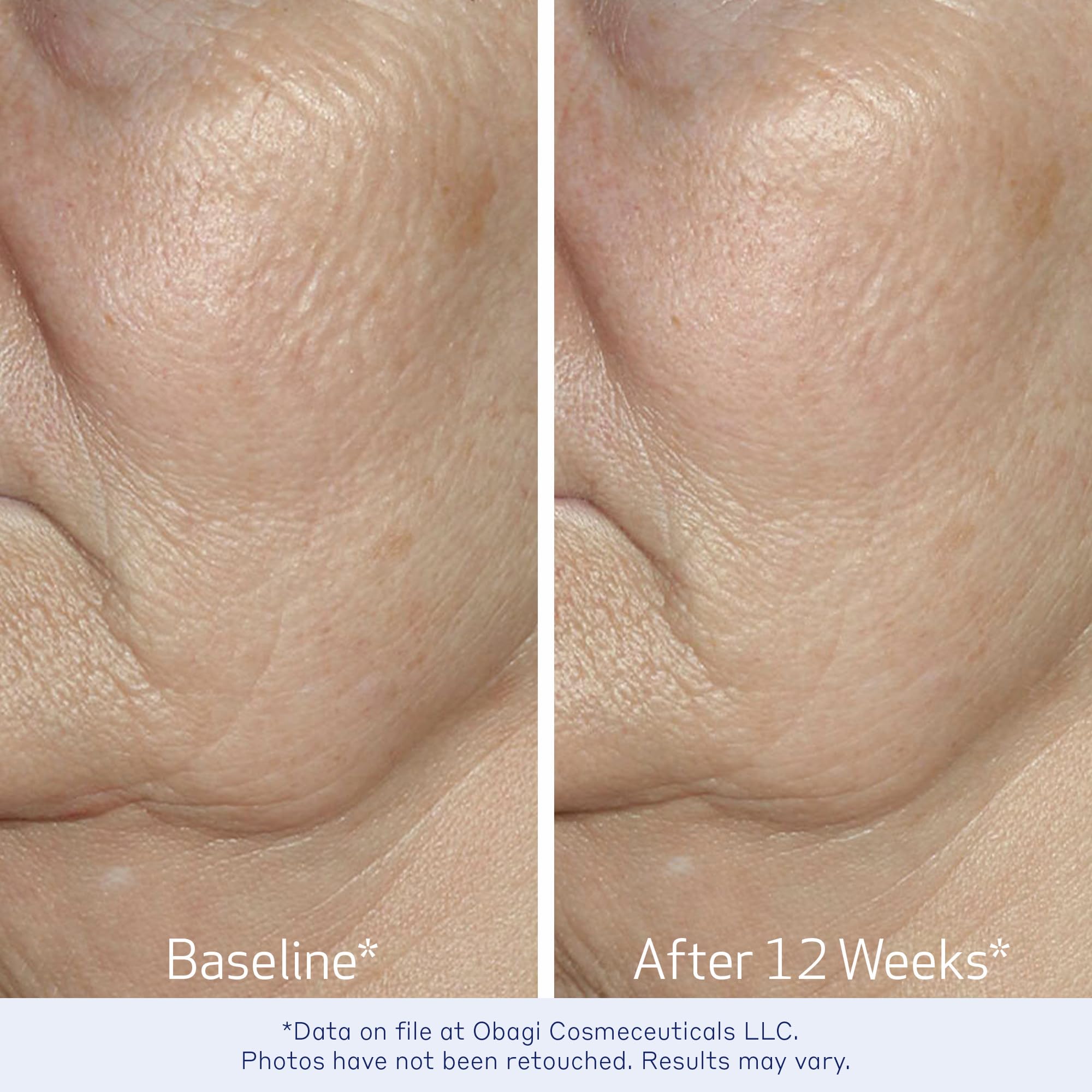 Obagi Elastiderm Serum, complejo Bi-Mineral destacado para el cuidado