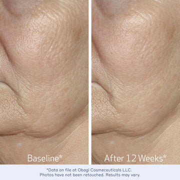 Obagi Elastiderm Serum, complejo Bi-Mineral destacado para el cuidado