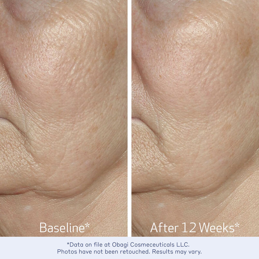 Obagi Elastiderm Serum, complejo Bi-Mineral destacado para el cuidado