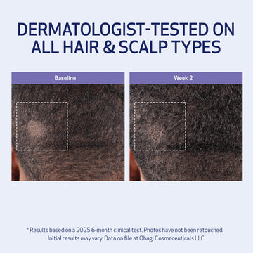 Obagi Nu-Cil BioStim fortalece folículos para cabello más denso