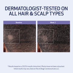 Obagi Nu-Cil BioStim fortalece folículos para cabello más denso