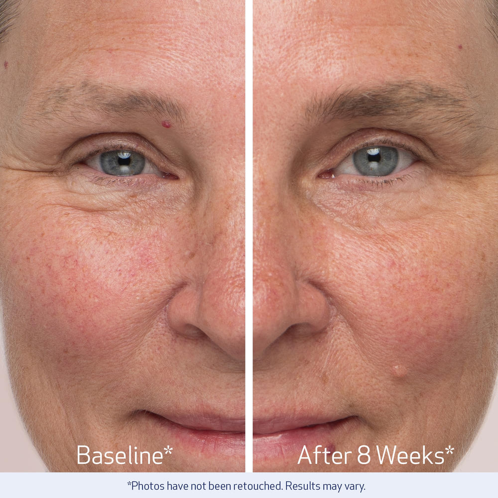 Obagi Nu-Cil Serum mostró mejoras de densidad y volumen en participantes.