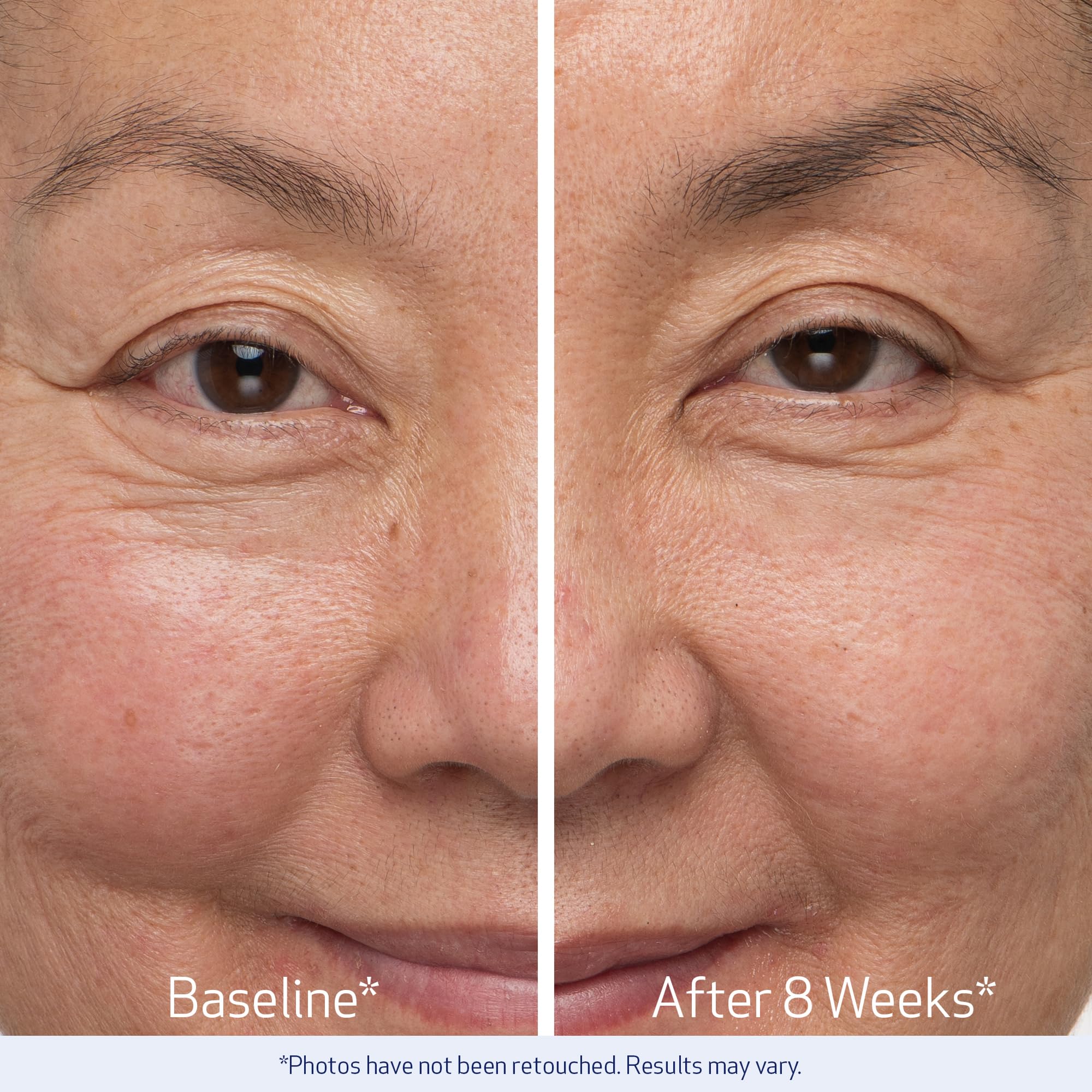 Combinación de ingredientes de Obagi Nu-Cil Serum para una apariencia más densa.