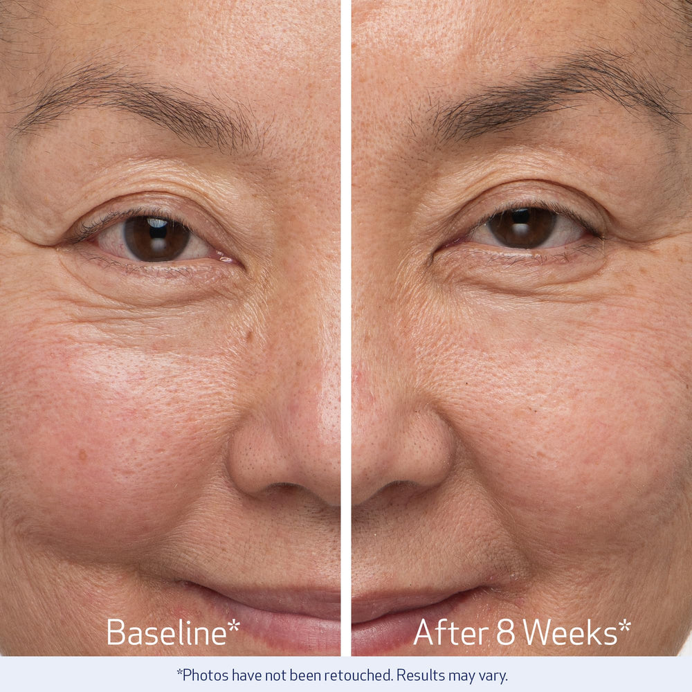 Combinación de ingredientes de Obagi Nu-Cil Serum para una apariencia más densa.