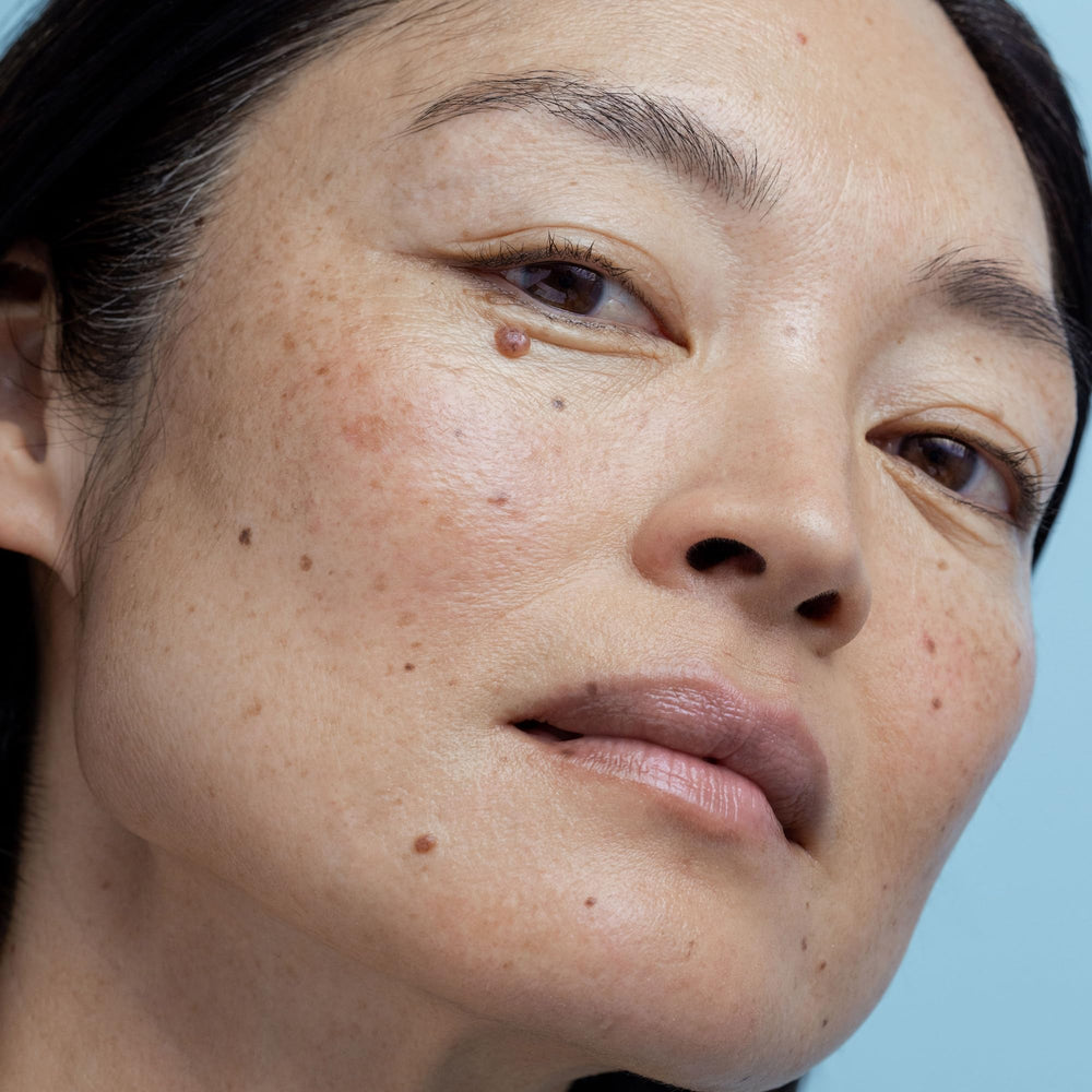Obagi Nu-Derm Exfoderm Forte, exfoliación inicial para preparar la piel.