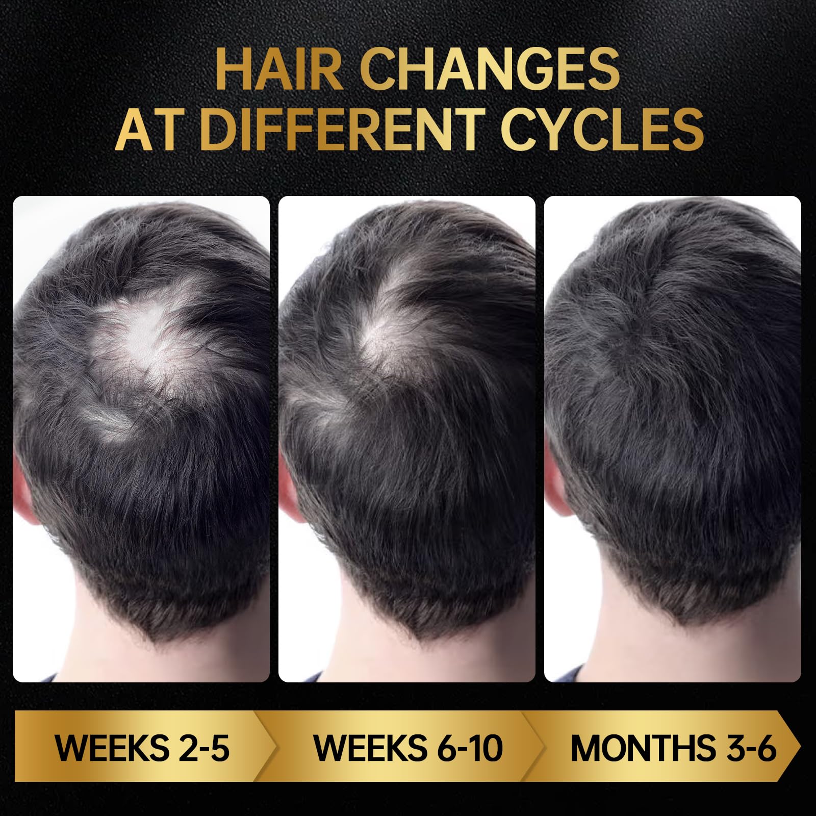 OCSINL Minoxidil formato práctico para llevar durante el día y viajar.