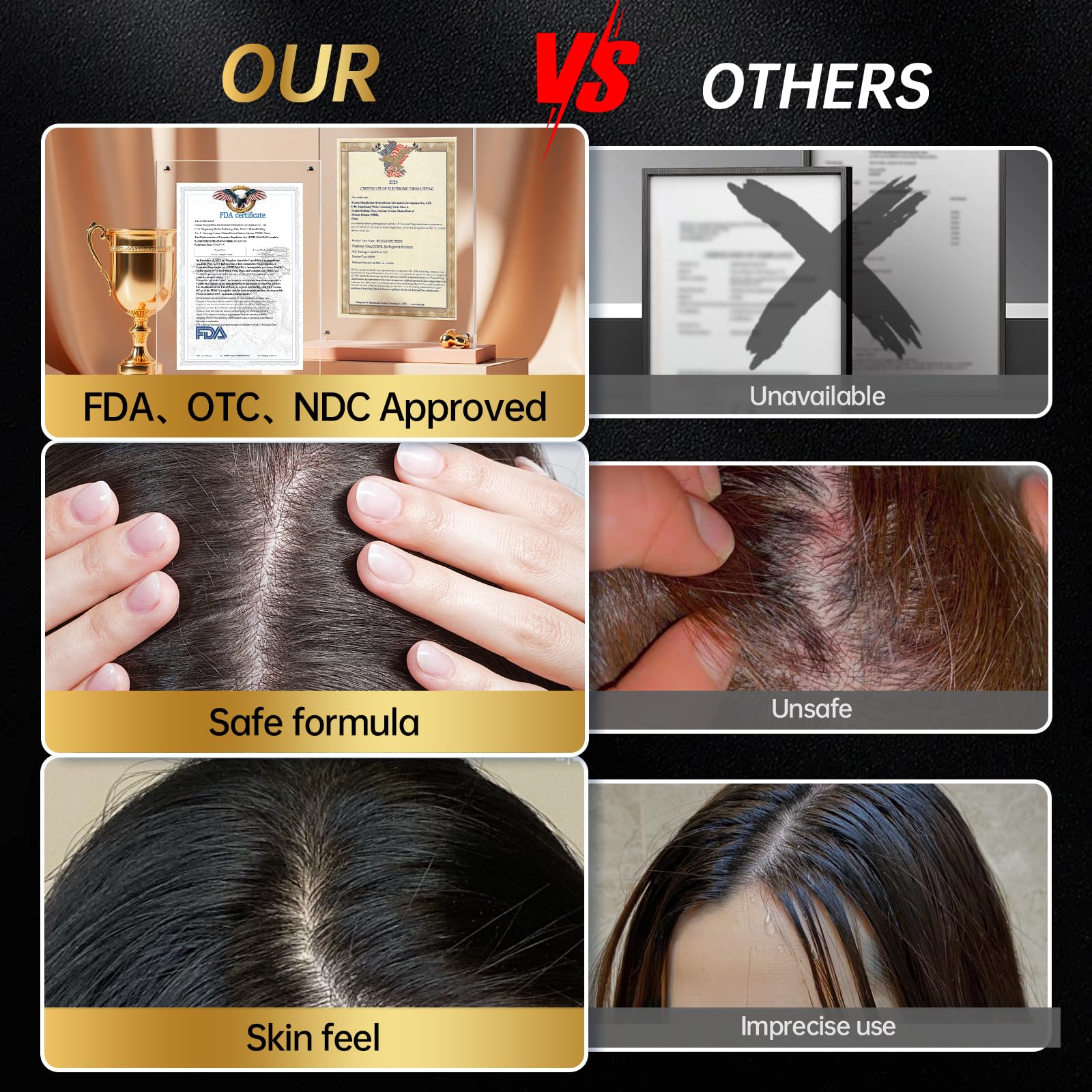 OCSINL Minoxidil posible resultado con uso constante en semanas.