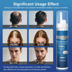 OCVWJKD Minoxidil espuma, uso para hombres y mujeres con barba y cejas