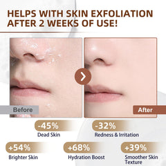 OLELON Exfoliación suave que redefine poros y piel más lisa