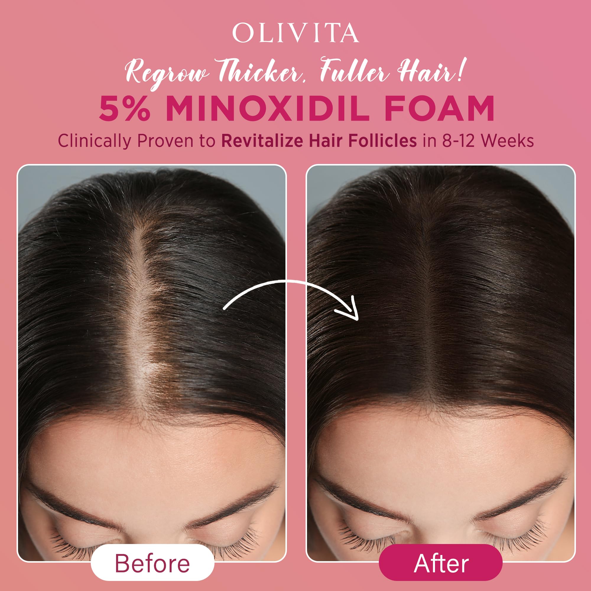 OLIVITA packaging box image emphasizes premium branding and investment in scalp-supporting care