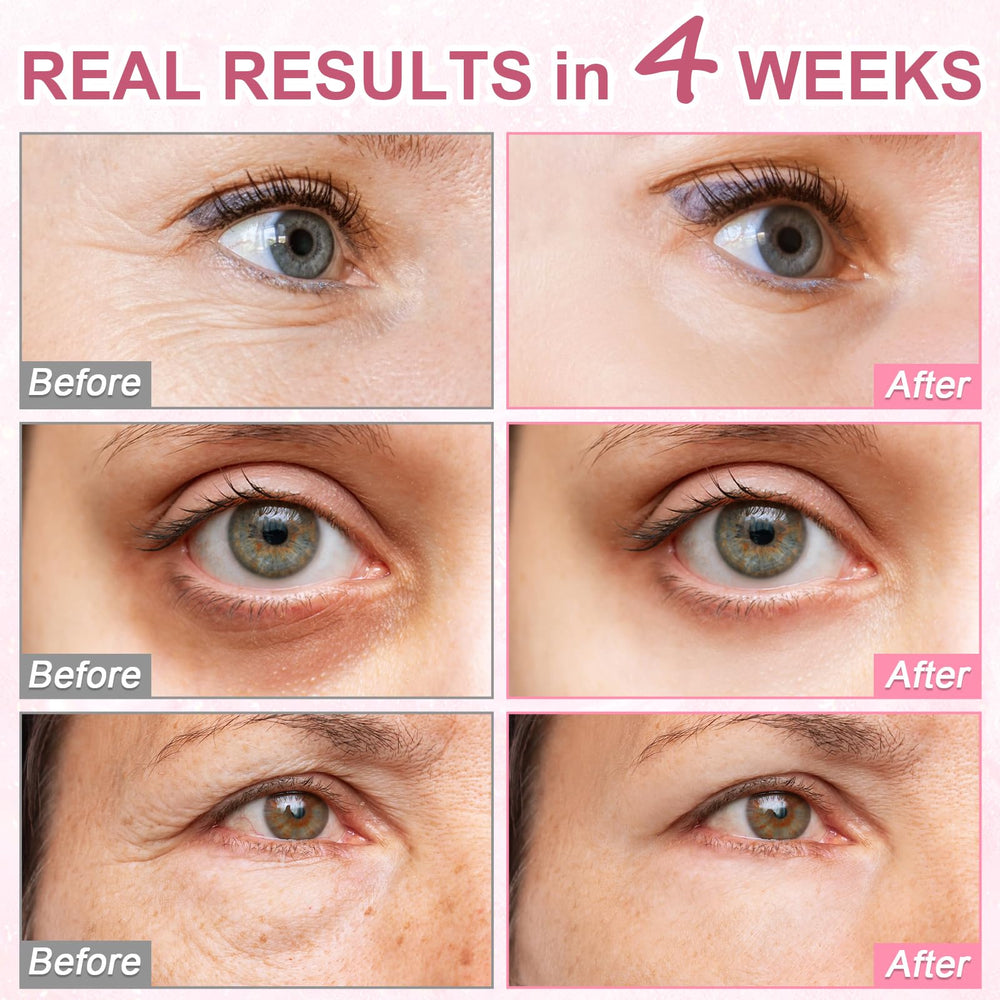 Omplen Serum Ojos Ácido Hialurónico ofrece hidratación profunda para la zona delicada
