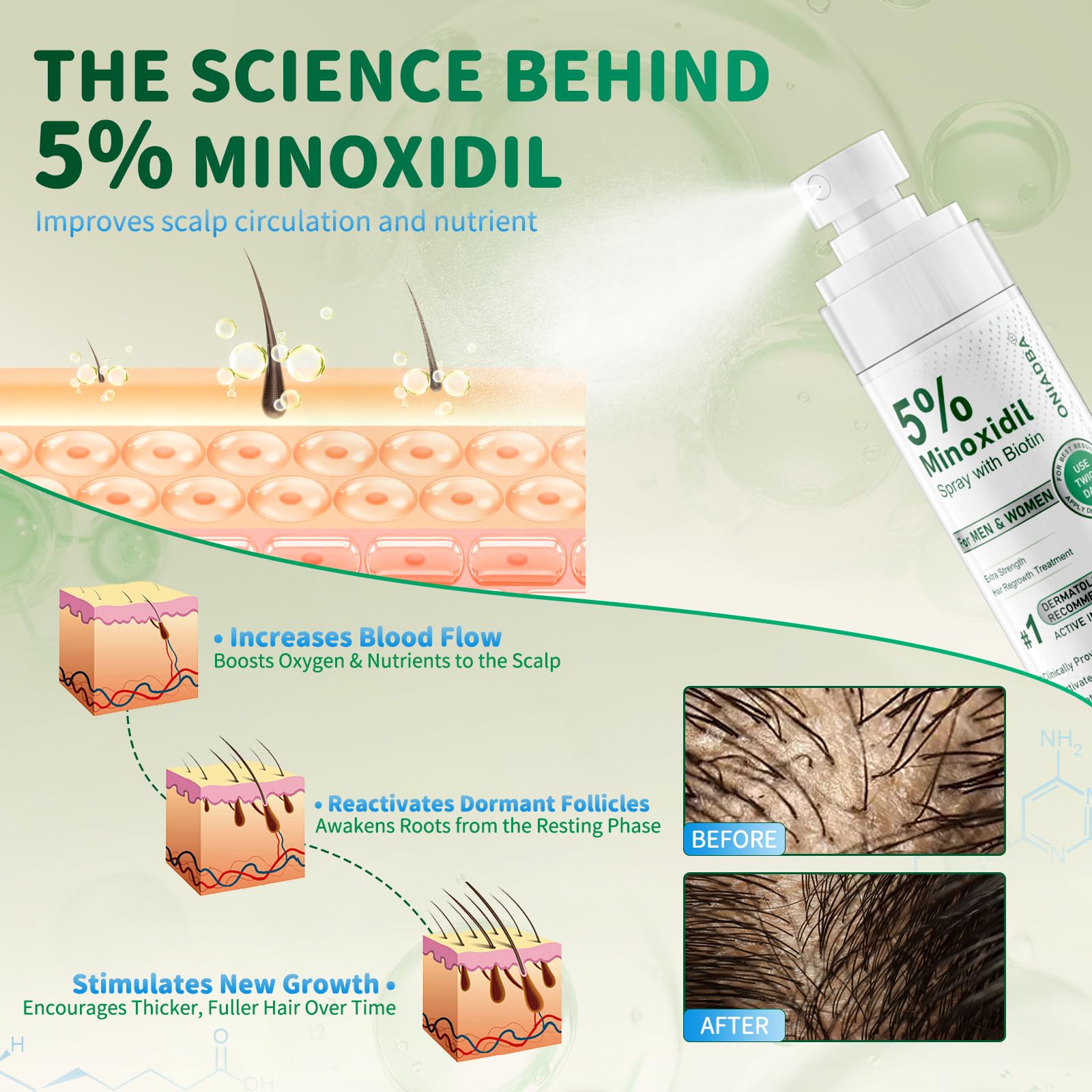 ONIADBA Minoxidil para cabello más denso y lleno.