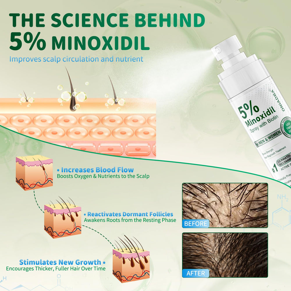 ONIADBA Minoxidil para cabello más denso y lleno.
