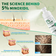ONIADBA Minoxidil para cabello más denso y lleno.