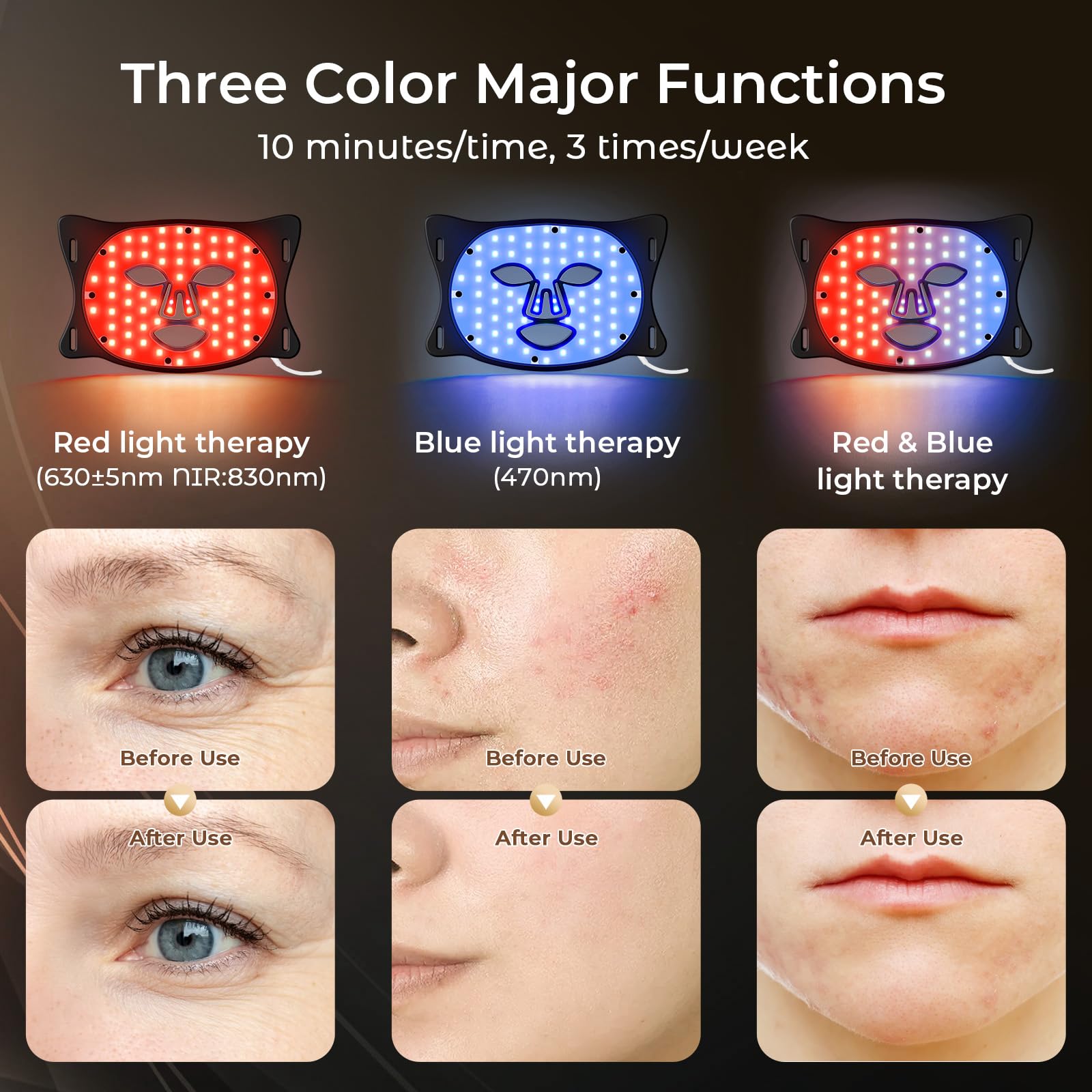 ONLUKY mascarilla LED silicona detalle materiales, piel suave.