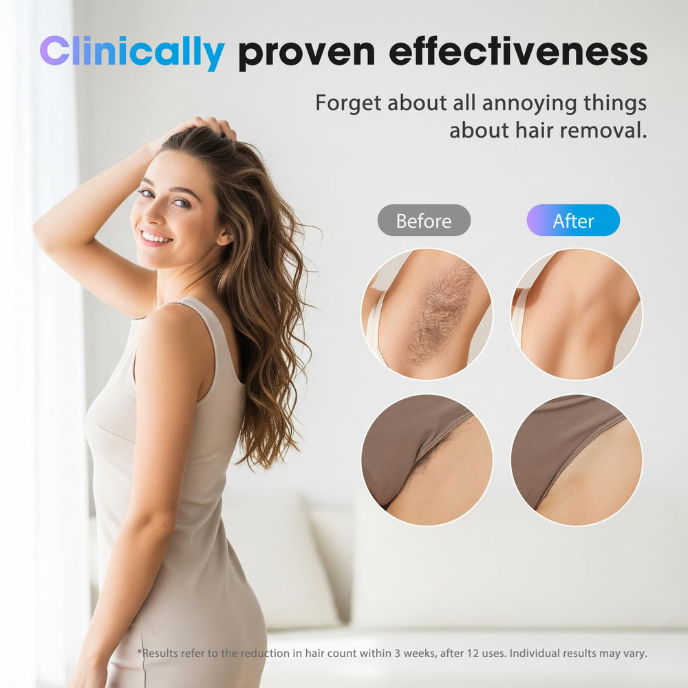 Oreeth IPL, enfriamiento a 7°C para sesiones más suaves.
