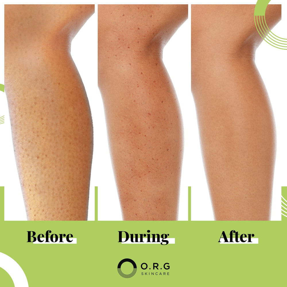 ORG exfoliante corporal apto piel sensible cuida sin irritación con fórmula natural