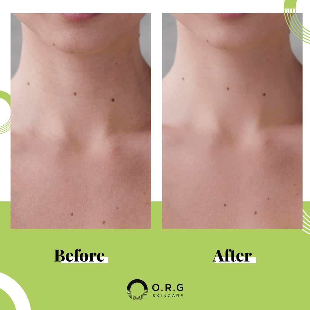ORG exfoliante corporal artemisia extracto alivia irritación y mejora textura