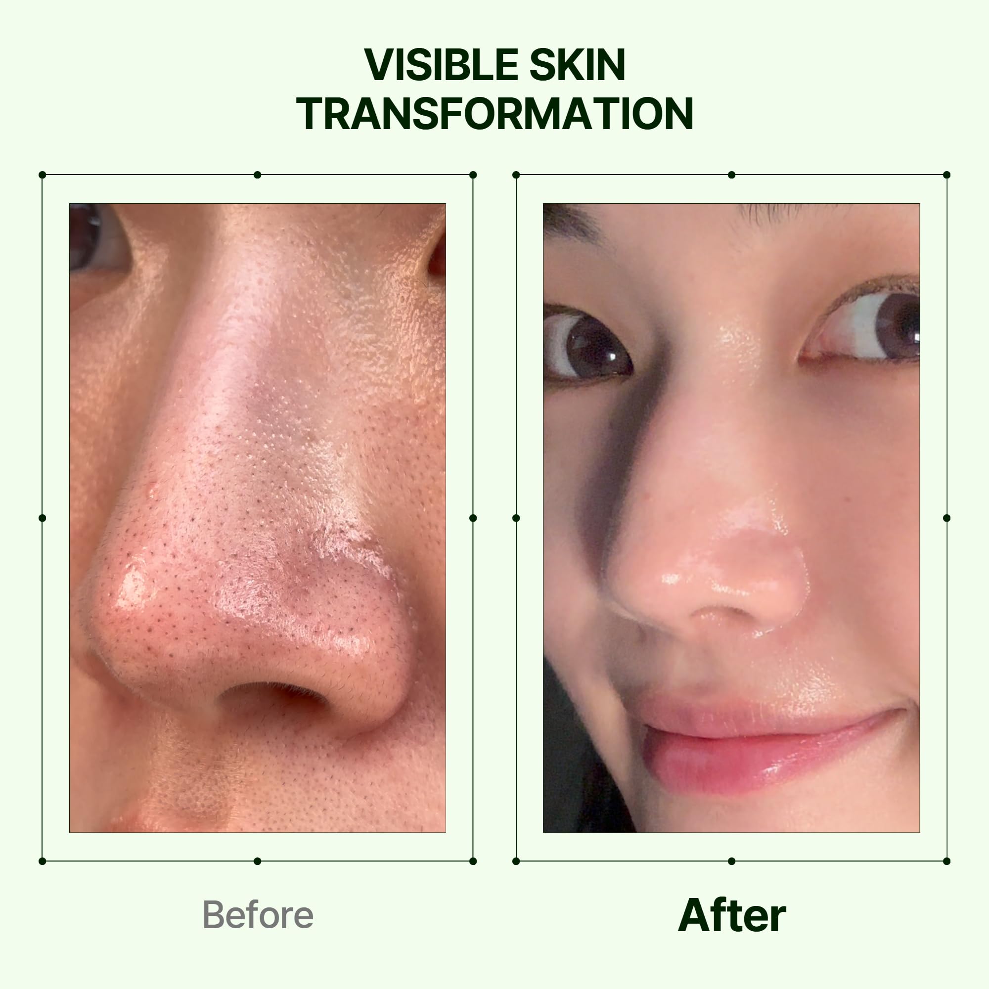 Orien Mugwort Zero Film Cleansing Oil sebum melt feature for clearer pores.