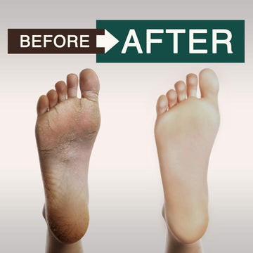 ORISO Tea Tree Oil Body Wash texturas suaves acompañan la rutina.