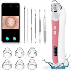 Ottleba extractor poros camara 1080p para ver la extraccion con detalle