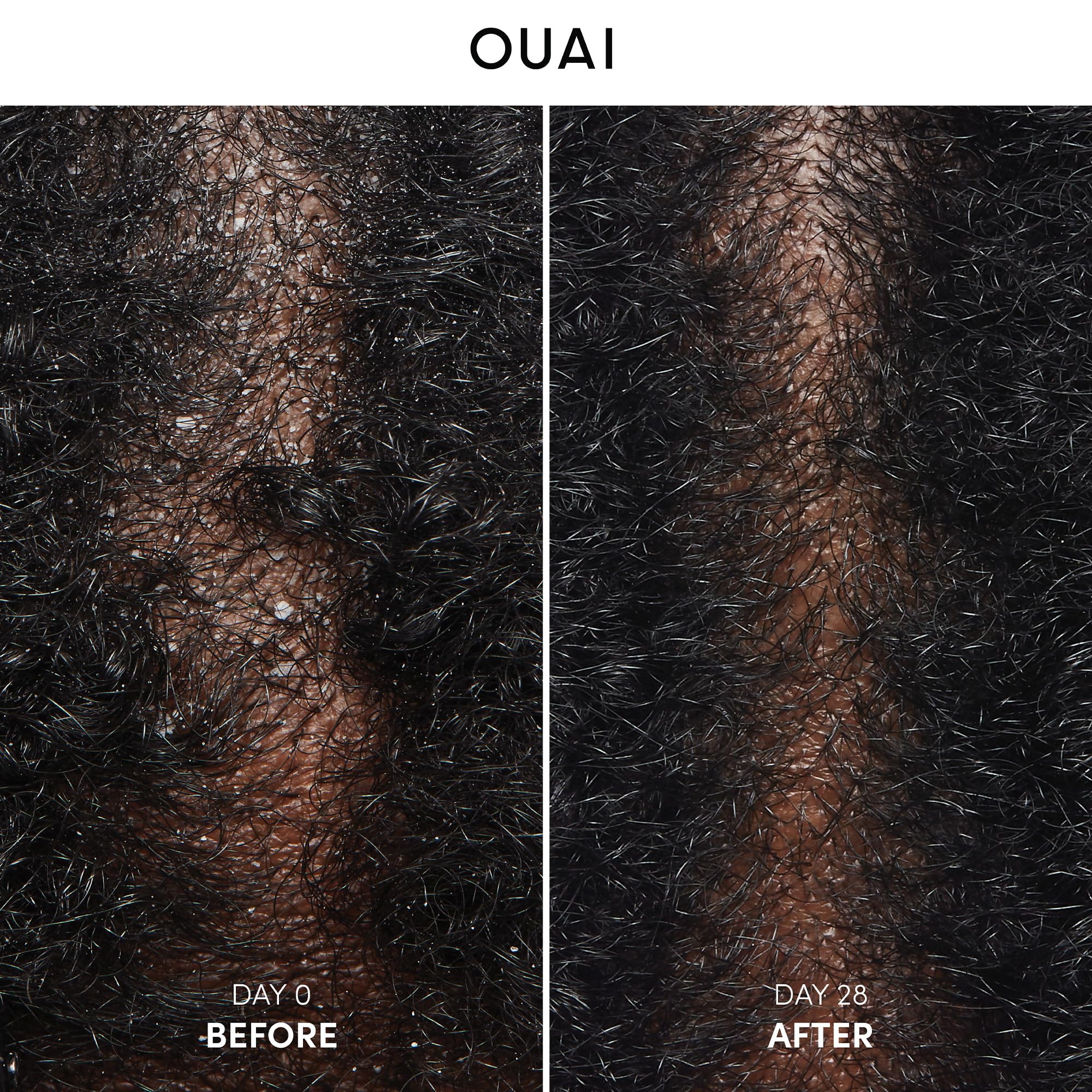 OUAI Champú Anticaspa aplicado con la mano para una cobertura suave y uniforme.