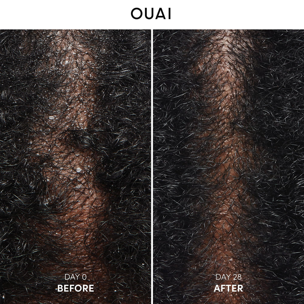 OUAI Champú Anticaspa aplicado con la mano para una cobertura suave y uniforme.
