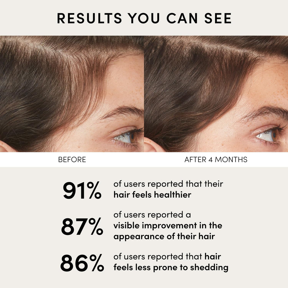 OUAI Scalp Serum Aplicación Diaria: uso sencillo para mantenimiento diario.