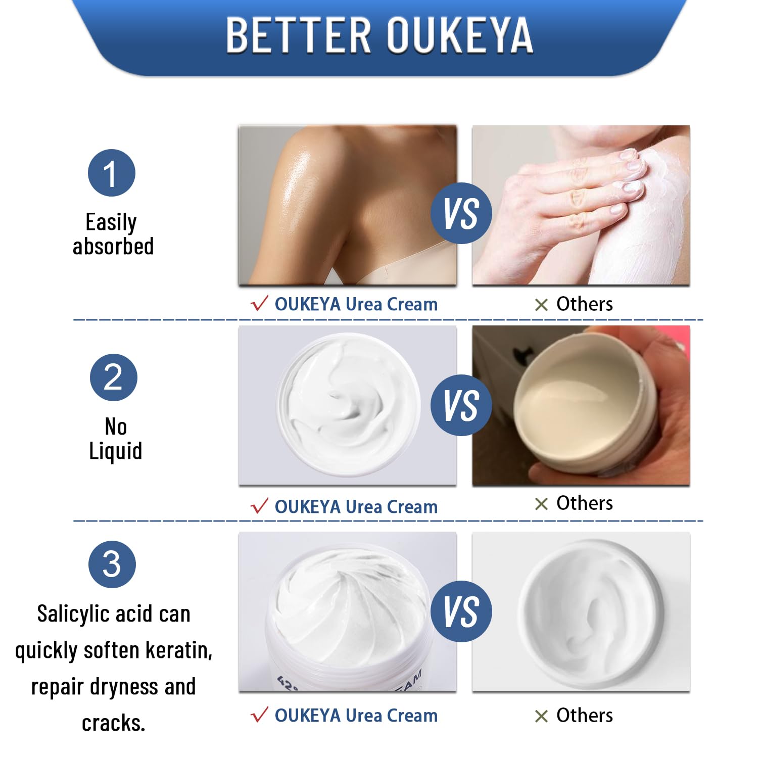 OUKEYA crema-urea-42-talones-agrietados: mejora la textura de zonas ásperas.