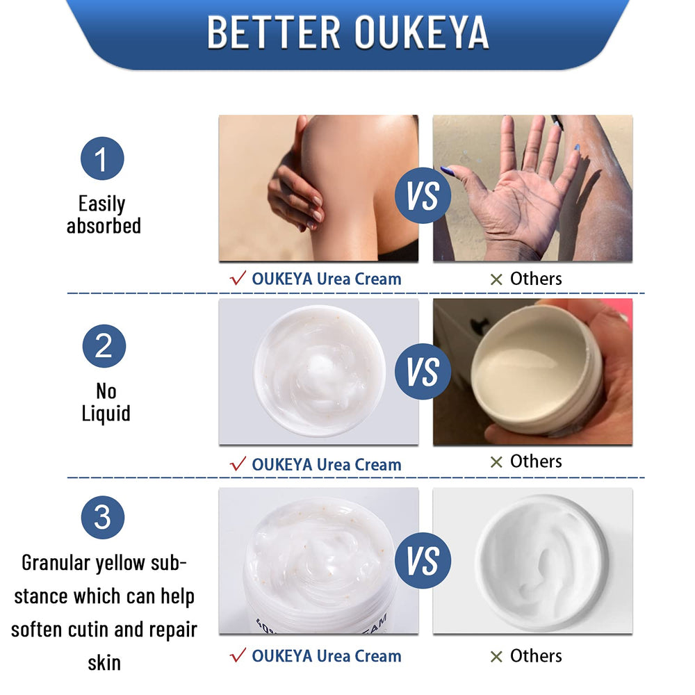 OUKEYA Urea Cream being applied to a dry heel