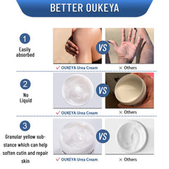 OUKEYA Urea Cream being applied to a dry heel