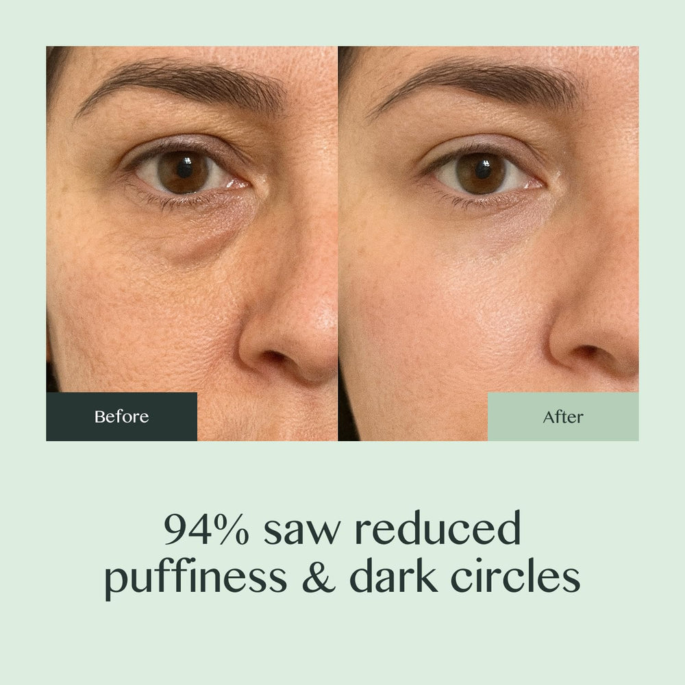 Ouraglow crema de ojos con ácido hialurónico para hidratación duradera.