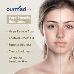 Ourmed Life: piel sensible, toallas suaves para limpieza facial diaria sin irritación.